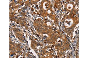 Immunohistochemistry (IHC) image for anti-Carcinoembryonic Antigen-Related Cell Adhesion Molecule 3 (CEACAM3) antibody (ABIN2432095) (CEACAM3 anticorps)