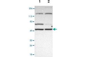 Western blot analysis of Lane 1: Human cell line RT-4, Lane 2: Human cell line U-251MG sp with MIPOL1 polyclonal antibody . (MIPOL1 anticorps)