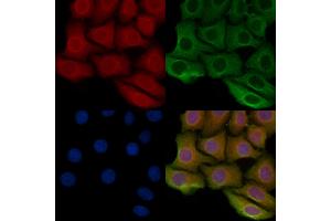 ABIN6259255 and ABIN6275356 staining Hela cells by IF/ICC. (PITPNB anticorps  (C-Term))