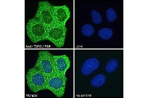 ABIN185697 Immunofluorescence analysis of paraformaldehyde fixed MCF7 cells, permeabilized with 0. (TSPO anticorps  (C-Term))
