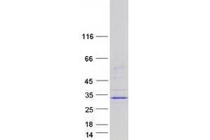 Validation with Western Blot