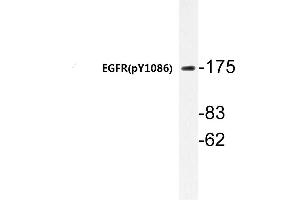 Western blot (WB) analyzes of p-EGFR antibody in extracts from HepG2 cells. (EGFR anticorps  (pTyr1110))