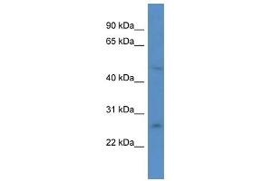 Western Blot showing ANKRD32 antibody used at a concentration of 1. (ANKRD32 anticorps  (N-Term))