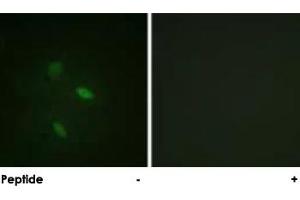 Immunofluorescence analysis of NIH/3T3 cells, using CCNE2 polyclonal antibody . (Cyclin E2 anticorps)