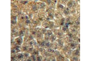IHC-P analysis of Liver tissue, with DAB staining. (ITIH2 anticorps  (AA 452-702))