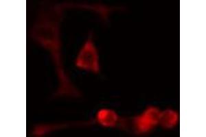 ABIN6274701 staining Hela cells by IF/ICC. (RAD51D anticorps  (C-Term))