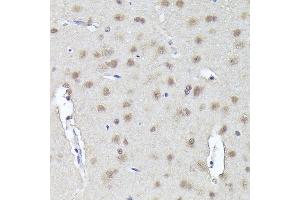 Immunohistochemistry of paraffin-embedded rat brain using CRCP Rabbit pAb (ABIN1679351, ABIN3019127, ABIN3019128 and ABIN6220728) at dilution of 1:200 (40x lens).
