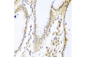 Immunohistochemistry of paraffin-embedded human stomach using MYBBP1A antibody at dilution of 1:100 (40x lens). (MYBBP1A anticorps)