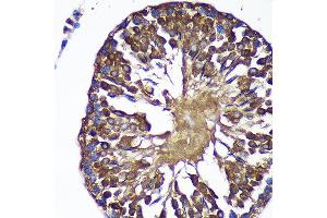Immunohistochemistry of paraffin-embedded Rat testis using SENP1 Rabbit pAb (ABIN6132646, ABIN6147534, ABIN6147536 and ABIN6216945) at dilution of 1:100 (40x lens). (SENP1 anticorps  (AA 220-420))