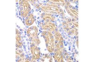 Immunohistochemistry of paraffin-embedded rat kidney using ALDH2 antibody.