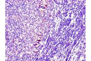 Immunohistochemistry of paraffin-embedded human lymph node tissue using ABIN7170721 at dilution of 1:100 (Stathmin 1 anticorps  (AA 13-78))