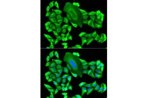 Immunofluorescence analysis of HeLa cell using MTAP antibody. (MTAP anticorps)
