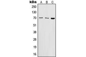 Western blot analysis of CD122 expression in BJAB (A), HuT78 (B), CTLL2 (C) whole cell lysates. (IL2 Receptor beta anticorps  (N-Term))