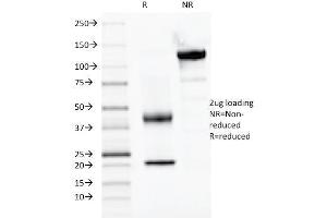 SDS-PAGE Analysis Purified PAX2, Monoclonal Antibody (PAX2/1104). (PAX2A anticorps  (AA 223-354))