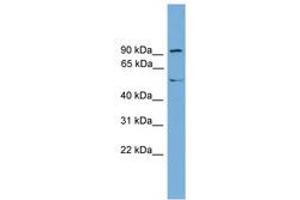 Image no. 1 for anti-Nuclear Receptor Subfamily 4, Group A, Member 3 (NR4A3) (AA 503-552) antibody (ABIN6744907) (NR4A3 anticorps  (AA 503-552))