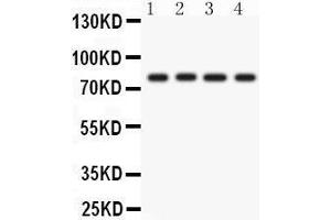 Western Blotting (WB) image for anti-Protein Kinase C, eta (PRKCH) (AA 30-389) antibody (ABIN3043361) (PKC eta anticorps  (AA 30-389))