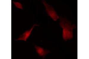 ABIN6269351 staining Hela by IF/ICC. (eIF4EBP1 anticorps  (Internal Region))