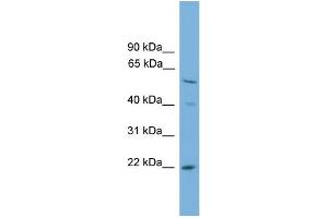 WB Suggested Anti-UBE2T Antibody Titration: 0. (Ube2t anticorps  (N-Term))