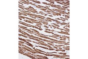 Immunohistochemical analysis of (ABIN1537893 and ABIN2848739) on paraffin-embedded Human heart tissue.