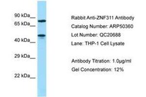 Image no. 1 for anti-Zinc Finger Protein 311 (ZNF311) (AA 187-236) antibody (ABIN6749919) (ZNF311 anticorps  (AA 187-236))