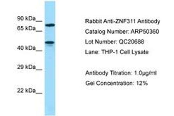 ZNF311 anticorps  (AA 187-236)