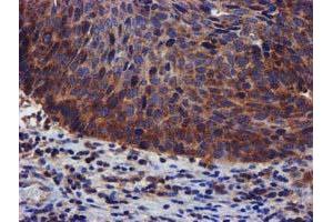 Image no. 1 for anti-PIH1 Domain Containing 2 (PIH1D2) (AA 1-315) antibody (ABIN1490740)