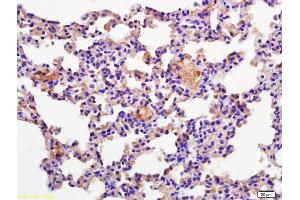 Formalin-fixed and paraffin embedded mouse lung labeled with Rabbit Anti CD69/CLEC2C/AIM Polyclonal Antibody, Unconjugated (ABIN741150) at 1:200 followed by conjugation to the secondary antibody and DAB staining