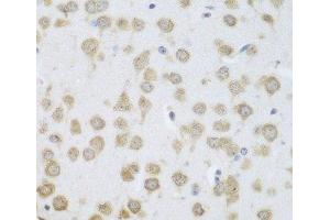 Immunohistochemistry of paraffin-embedded Mouse brain using GRPEL2 Polyclonal Antibody at dilution of 1:100 (40x lens). (GRPEL2 anticorps)