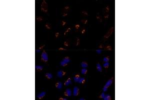Immunofluorescence analysis of U-2 OS cells using MTCH2 Polyclonal Antibody  at dilution of 1:100 (40x lens).