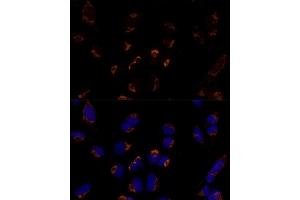 Immunofluorescence analysis of U-2 OS cells using MTCH2 Polyclonal Antibody  at dilution of 1:100 (40x lens). (MTCH2 anticorps  (AA 30-175))
