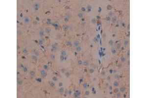 IHC-P analysis of brain tissue, with DAB staining. (DLG5 anticorps  (AA 1724-1917))