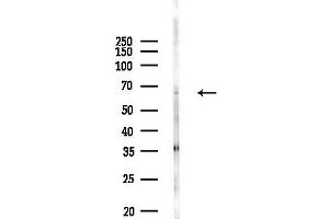 Western blot analysis of lysates from MDA-MB-231 cells(heat-shock, 45 min treatment), using SCNN1D Antibody at 1/1000 dilution.