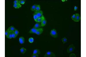 Immunofluorescence staining of HepG2 cells with ABIN7127390 at 1:33, counter-stained with DAPI. (Recombinant CCR9 anticorps)