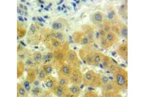 Used in DAB staining on fromalin fixed paraffin-embedded Liver tissue