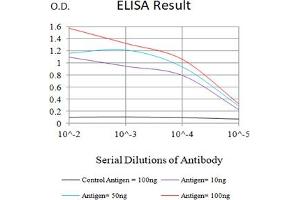 Black line: Control Antigen (100 ng),Purple line: Antigen (10 ng), Blue line: Antigen (50 ng), Red line:Antigen (100 ng)