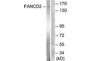 Western Blotting (WB) image for anti-Fanconi Anemia, Complementation Group D2 (FANCD2) (AA 188-237) antibody (ABIN2888629) (FANCD2 anticorps  (AA 188-237))