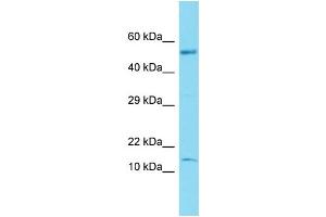 Host: Rabbit Target Name: C17orf103 Sample Type: Fetal Brain lysates Antibody Dilution: 1. (GTLF3B anticorps  (N-Term))