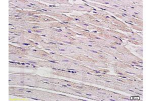 Formalin-fixed and paraffin embedded rat myocardium tissue labeled with Anti-Connexin-40 Polyclonal Antibody, Unconjugated (ABIN736926) at 1:200, followed by conjugation to the secondary antibody and DAB staining (Cx40/GJA5 anticorps  (AA 301-358))