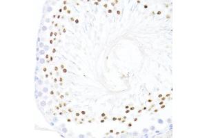 Immunohistochemistry of paraffin-embedded rat testis using DDX59 antibody (ABIN7266702) at dilution of 1:100 (40x lens). (DDX59 anticorps  (AA 1-250))