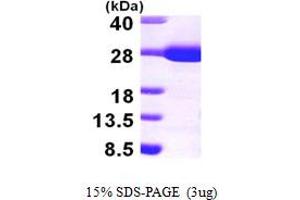 SDS-PAGE (SDS) image for rho GDP Dissociation Inhibitor (GDI) alpha (ARHGDIA) (AA 24-204) protein (His tag) (ABIN667259) (ARHGDIA Protein (AA 24-204) (His tag))