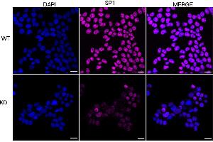 Immunocytochemical staining of HeLa cells using SP1 antibody (ABIN7800415), 1:1,000), Top panel: wild-type (WT), Bottom panal: SP1 shRNA knockdown (KD). (SP1 anticorps)
