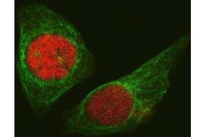 IF analysis of STAG2 using anti-STAG2 antibody (ABIN7602420) and anti-Tubulin Alpha antibody (ABIN7600339).