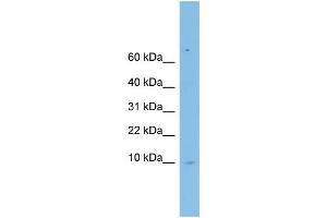 WB Suggested Anti-LSM6 Antibody Titration: 0. (LSM6 anticorps  (Middle Region))