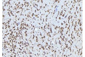 ABIN6272861 at 1/100 staining Mouse brain tissue by IHC-P. (ADAM12 anticorps  (N-Term))