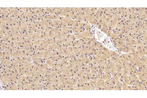 Detection of CEACAM1 in Human Liver Tissue using Monoclonal Antibody to Carcinoembryonic Antigen Related Cell Adhesion Molecule 1 (CEACAM1)