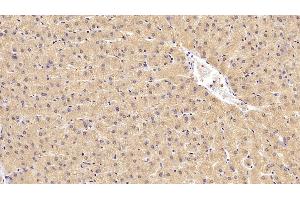 Detection of CEACAM1 in Human Liver Tissue using Monoclonal Antibody to Carcinoembryonic Antigen Related Cell Adhesion Molecule 1 (CEACAM1) (CEACAM1 anticorps)