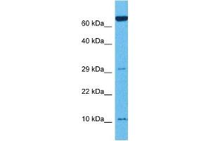 Host:  Rabbit  Target Name:  TNFRSF12A  Sample Tissue:  Mouse Thymus  Antibody Dilution:  1ug/ml (TNFRSF12A anticorps  (N-Term))