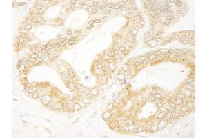 Immunohistochemistry (IHC) image for anti-Eukaryotic Translation Initiation Factor 4H (EIF4H) (AA 198-248) antibody (ABIN7448549)
