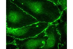 anti-DYKDDDDK Tag antibody