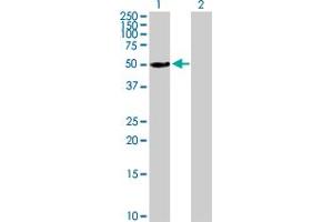 Western Blot analysis of ALDH3A1 expression in transfected 293T cell line by ALDH3A1 MaxPab polyclonal antibody.